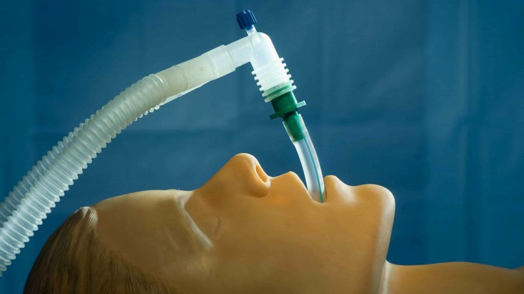 ¿Pero cómo? El paro cardiorespiratorio, el coma y el ventilador